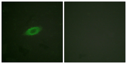 Annexin VI Rabbit Polyclonal Antibody
