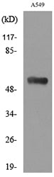 Annexin VII Rabbit Polyclonal Antibody