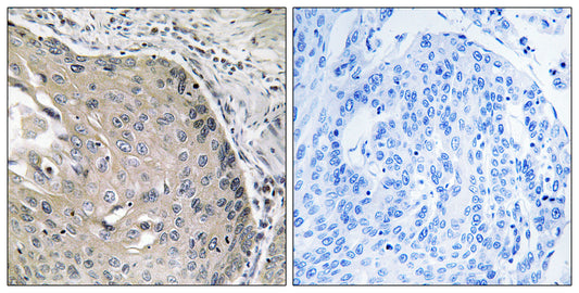 AOX1 Rabbit Polyclonal Antibody