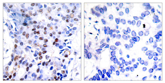 AP-1 Rabbit Polyclonal Antibody