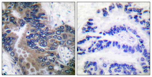 Apaf-1-ALT Rabbit Polyclonal Antibody