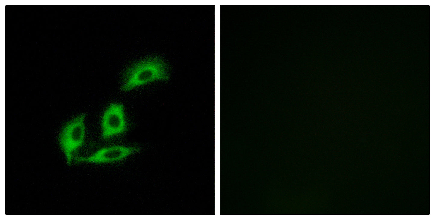 APBA2BP Rabbit Polyclonal Antibody