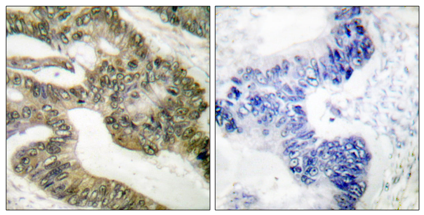APC Rabbit Polyclonal Antibody