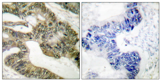 APC Rabbit Polyclonal Antibody