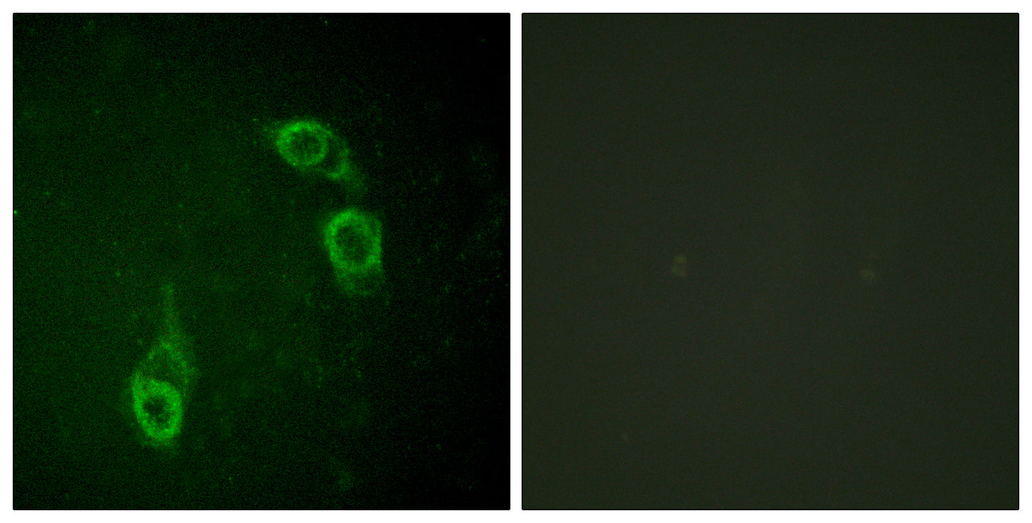 APC1 Rabbit Polyclonal Antibody
