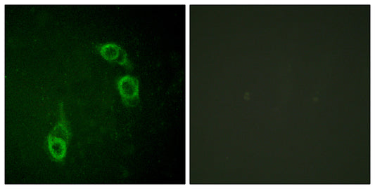 APC1 Rabbit Polyclonal Antibody