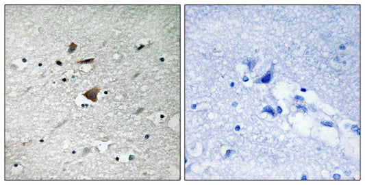 APC1 Rabbit Polyclonal Antibody