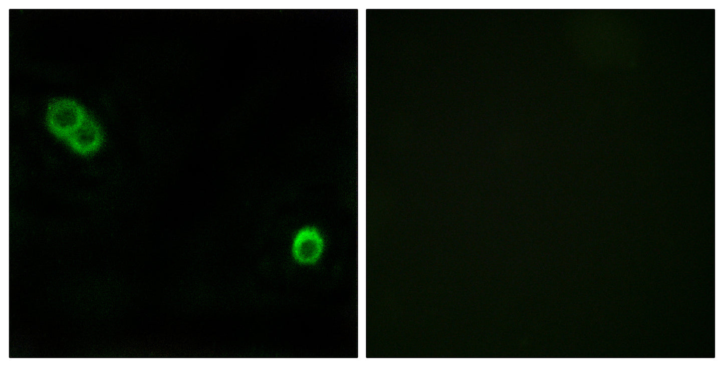 APHC Rabbit Polyclonal Antibody