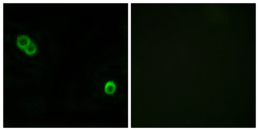 APHC Rabbit Polyclonal Antibody
