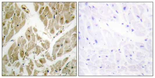 API5 Rabbit Polyclonal Antibody