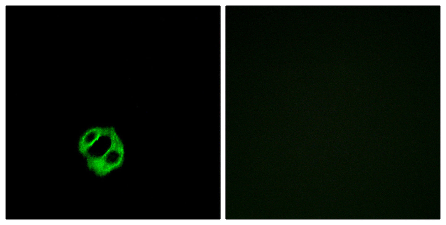 APLNR Rabbit Polyclonal Antibody