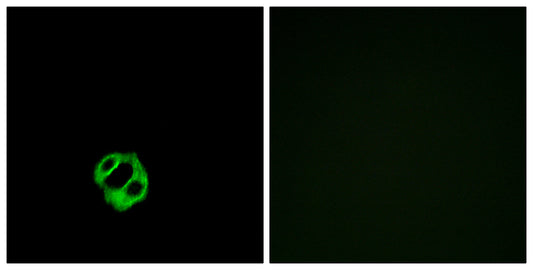 APLNR Rabbit Polyclonal Antibody