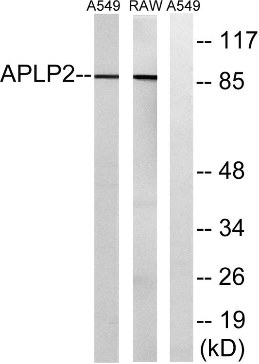 APLP-2 Rabbit Polyclonal Antibody