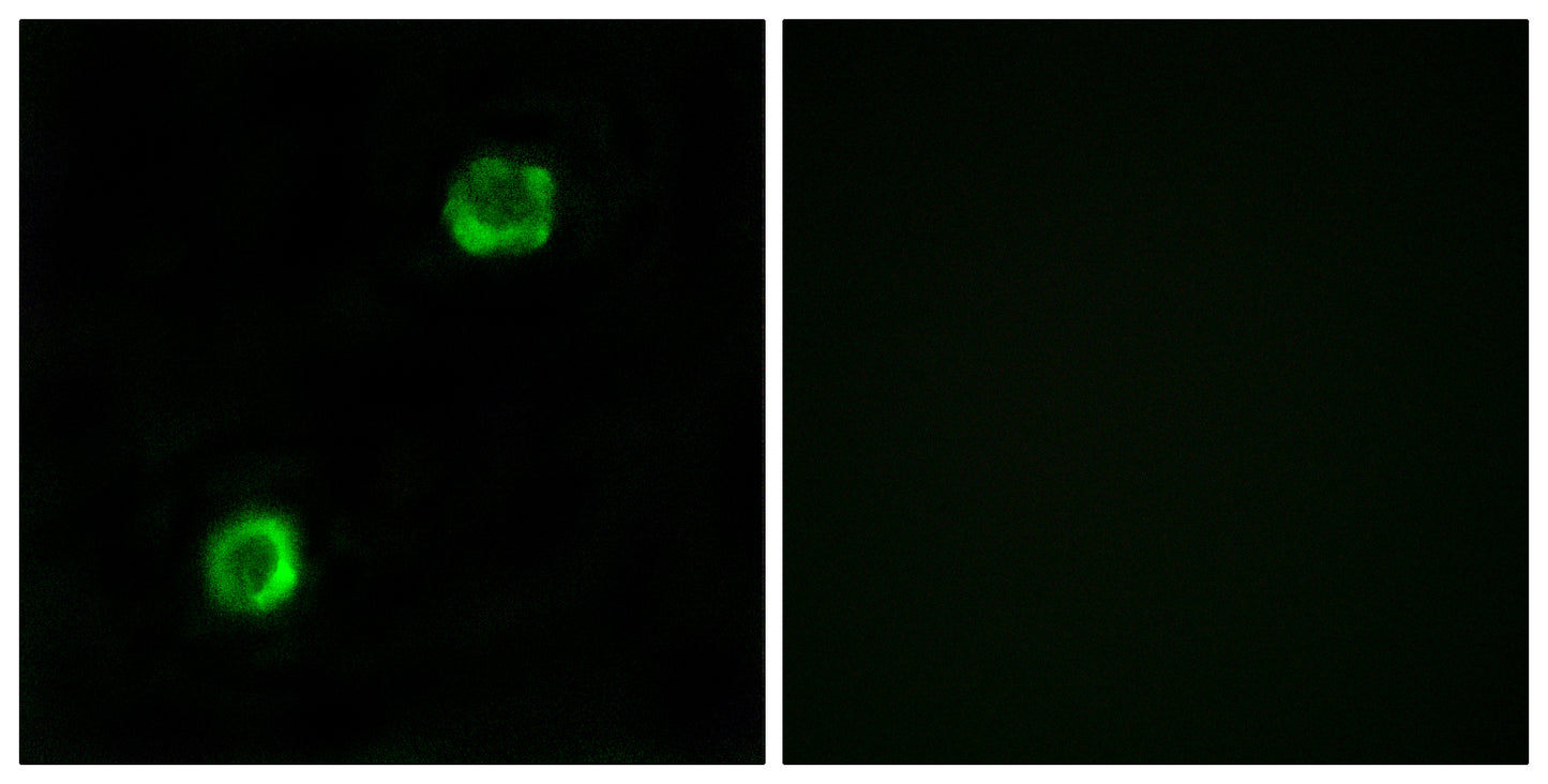 ApoL2 Rabbit Polyclonal Antibody