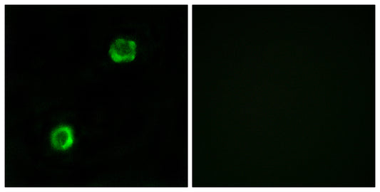 ApoL2 Rabbit Polyclonal Antibody