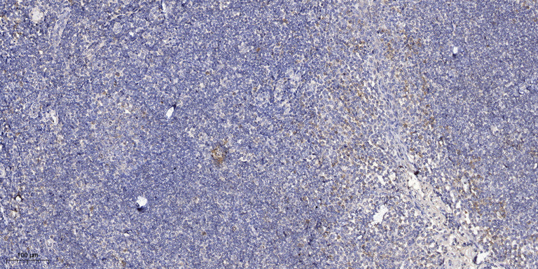 ApoL3 Rabbit Polyclonal Antibody