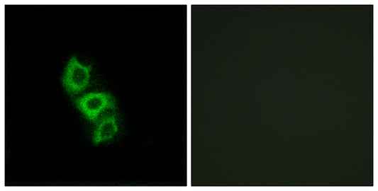 ApoL5 Rabbit Polyclonal Antibody