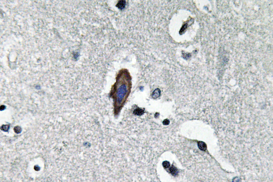 AQP0 Rabbit Polyclonal Antibody