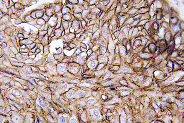 AQP3 Rabbit Polyclonal Antibody