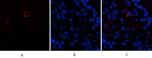 AR Rabbit Polyclonal Antibody