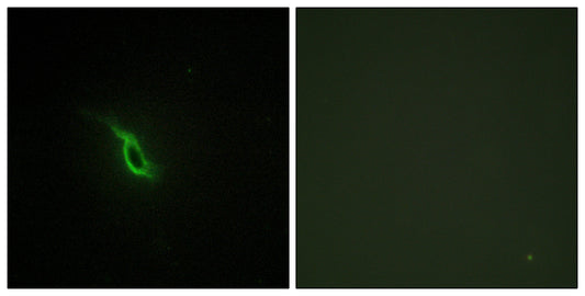 AR α2A Rabbit Polyclonal Antibody