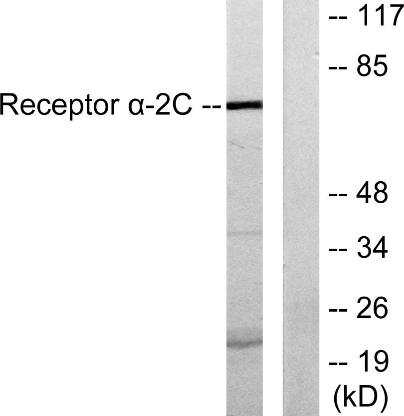 AR α2C Rabbit Polyclonal Antibody