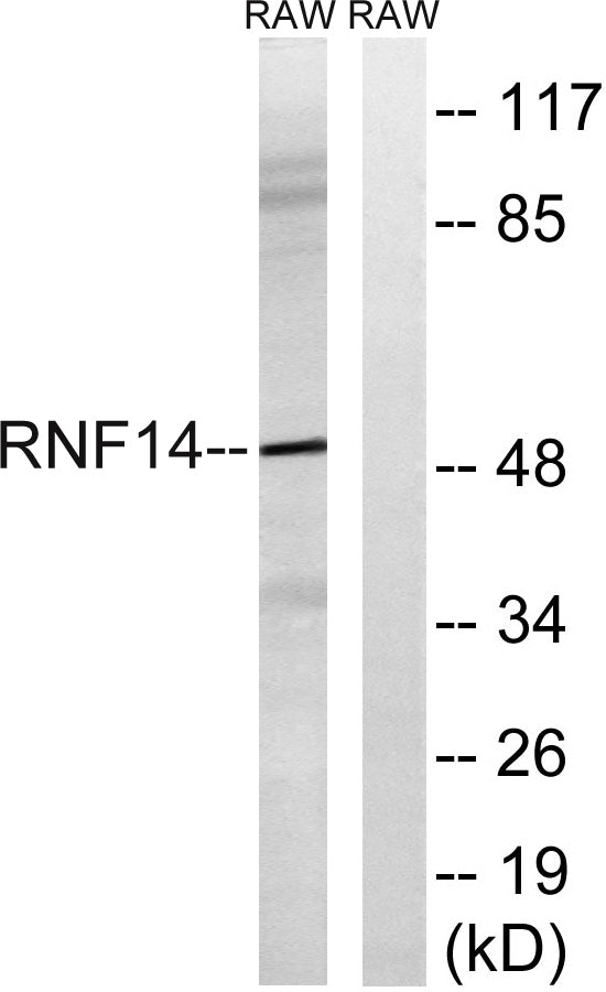 ARA54 Rabbit Polyclonal Antibody