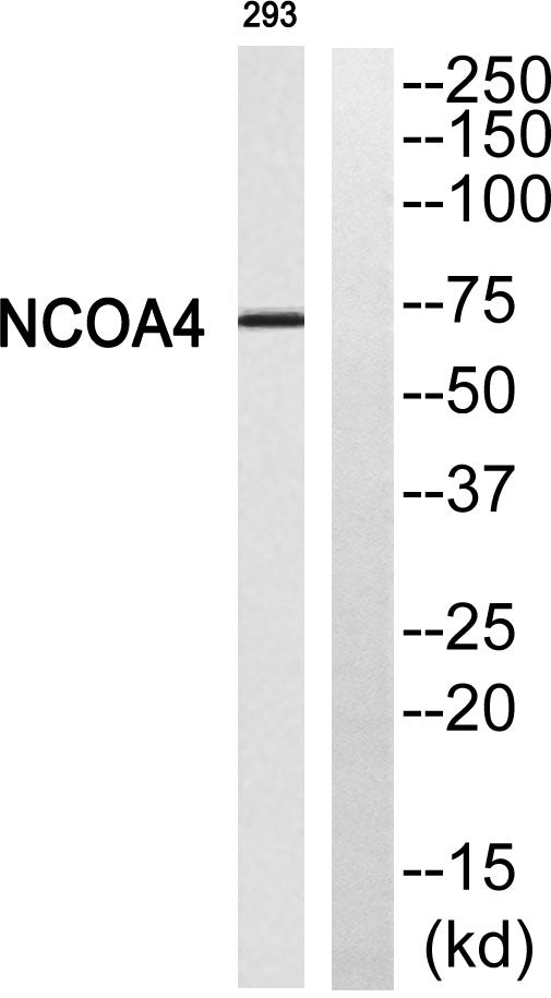 ARA70 Rabbit Polyclonal Antibody