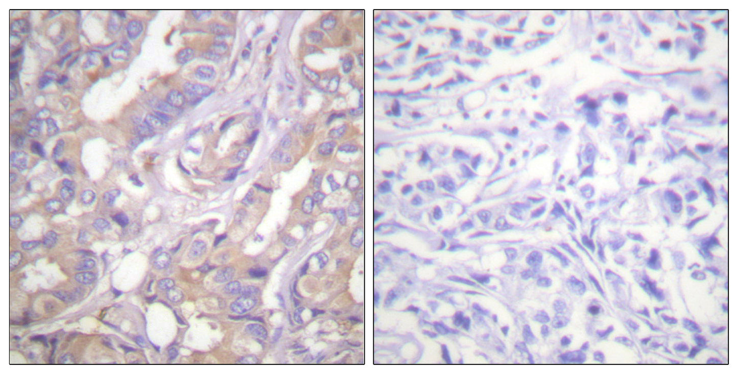 A-Raf Rabbit Polyclonal Antibody