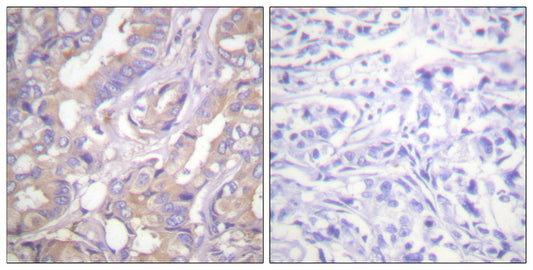 A-Raf Rabbit Polyclonal Antibody
