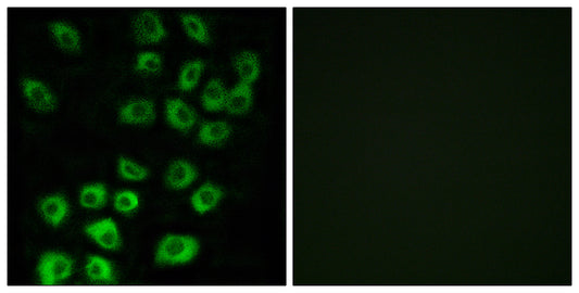 ARF GAP1 Rabbit Polyclonal Antibody