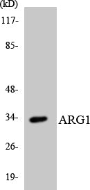 Arginase I Rabbit Polyclonal Antibody