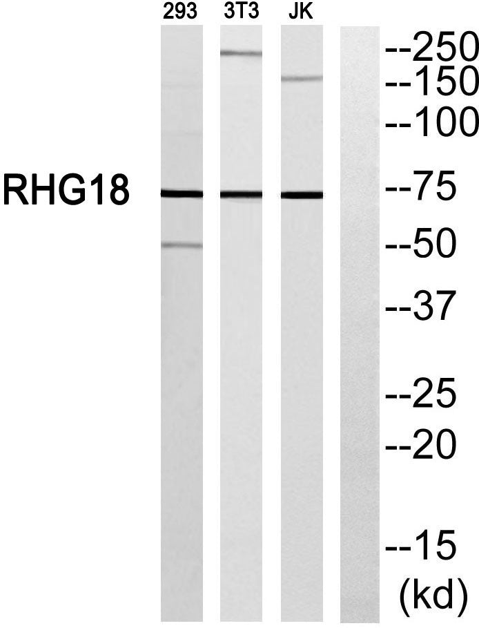 ARHGAP18 Rabbit Polyclonal Antibody