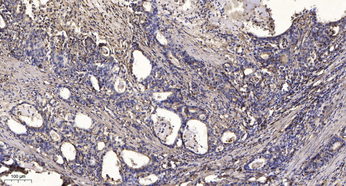 ARHGAP23 Rabbit Polyclonal Antibody