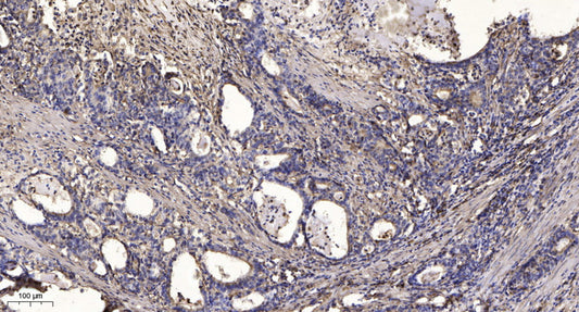 ARHGAP23 Rabbit Polyclonal Antibody