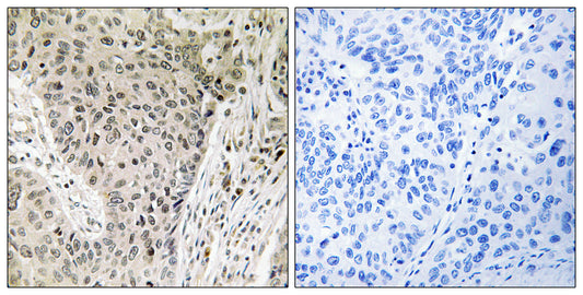 ARHGEF19 Rabbit Polyclonal Antibody