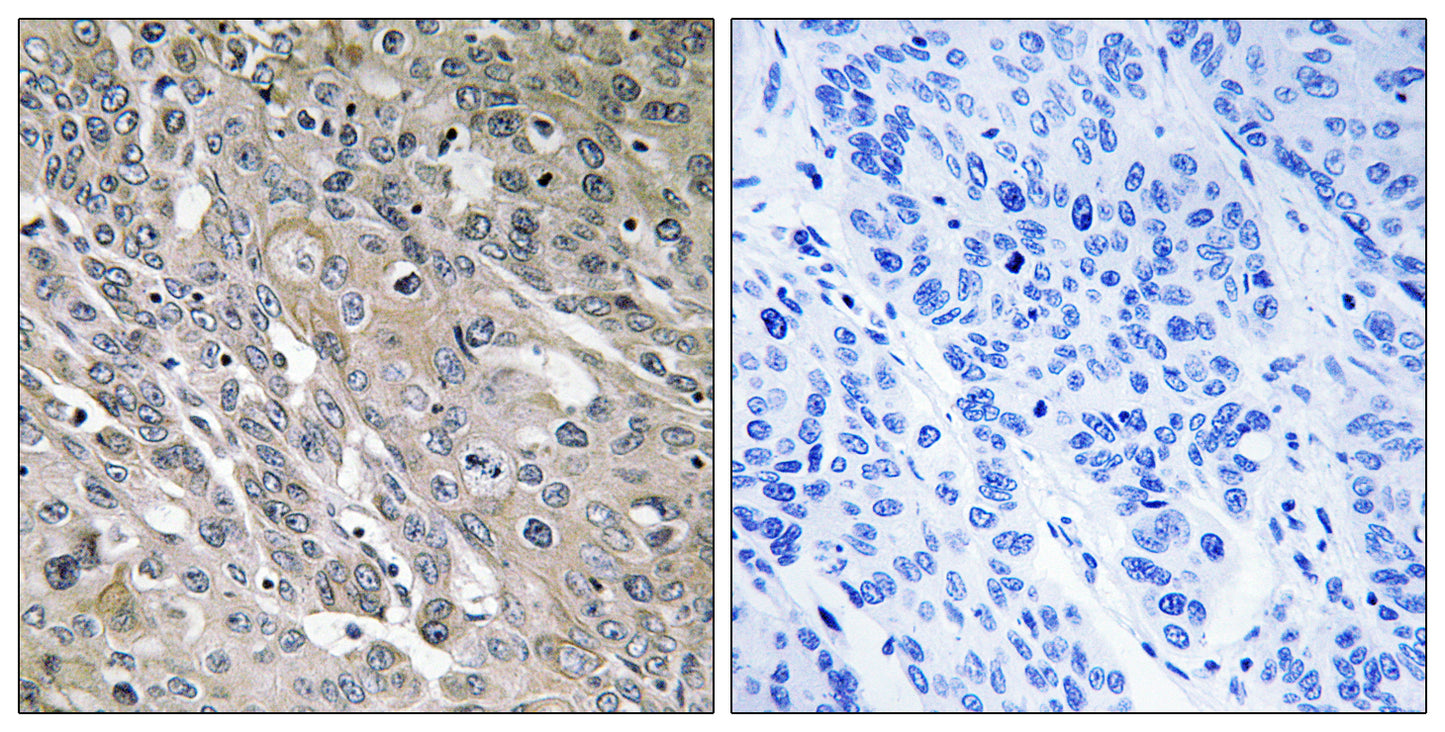 ARHGEF9 Rabbit Polyclonal Antibody