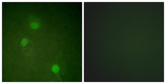 ARK-2 Rabbit Polyclonal Antibody