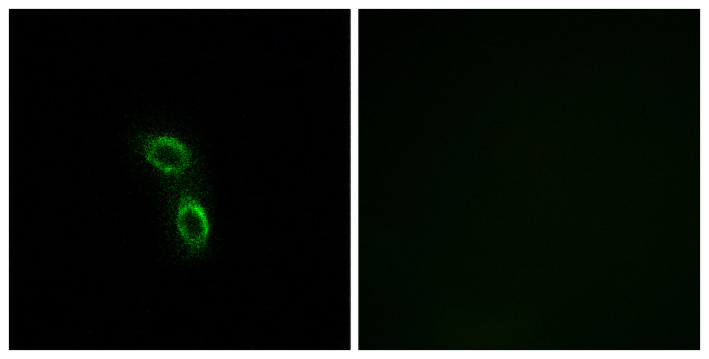ARMC6 Rabbit Polyclonal Antibody