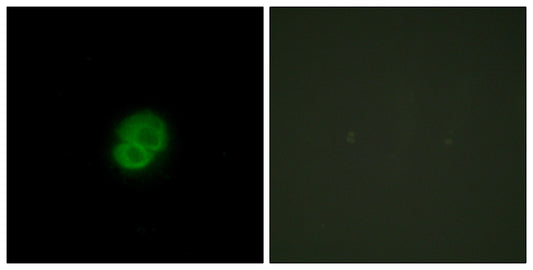 ARMCX2 Rabbit Polyclonal Antibody