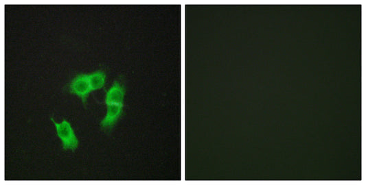 ARMCX3 Rabbit Polyclonal Antibody