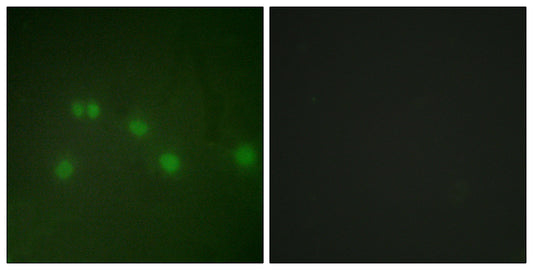 ARP-1 Rabbit Polyclonal Antibody