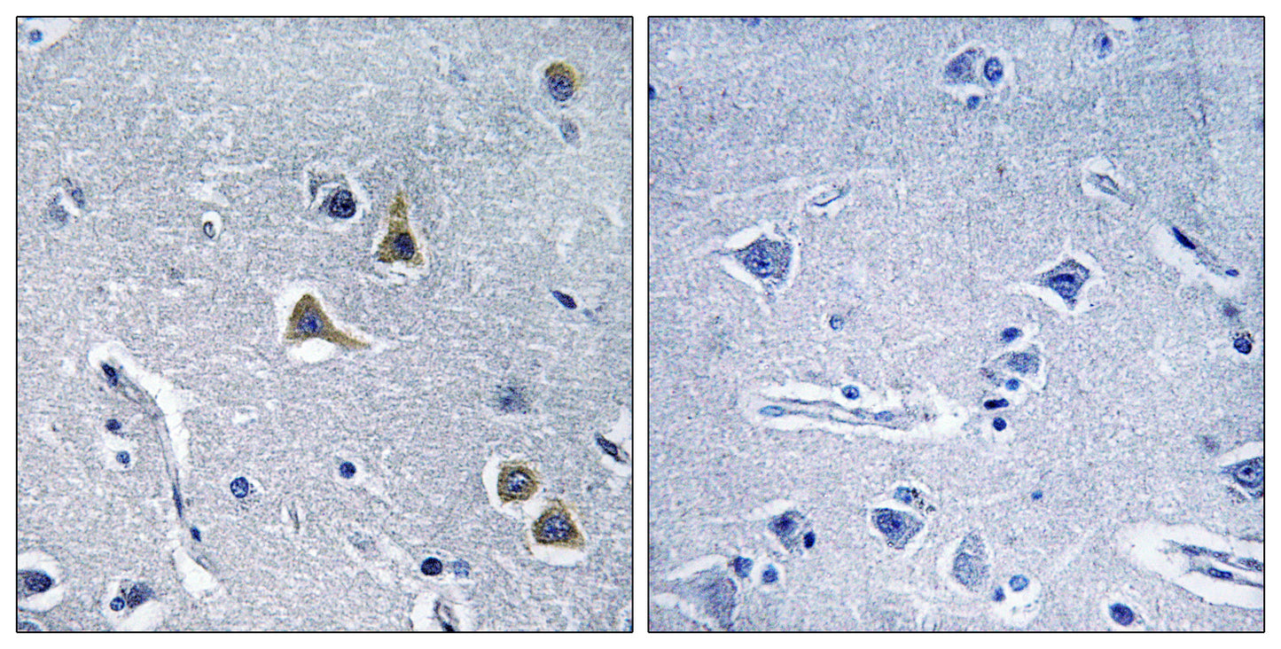 ARRDC2 Rabbit Polyclonal Antibody