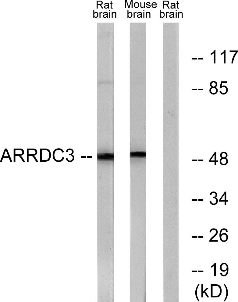 ARRDC3 Rabbit Polyclonal Antibody