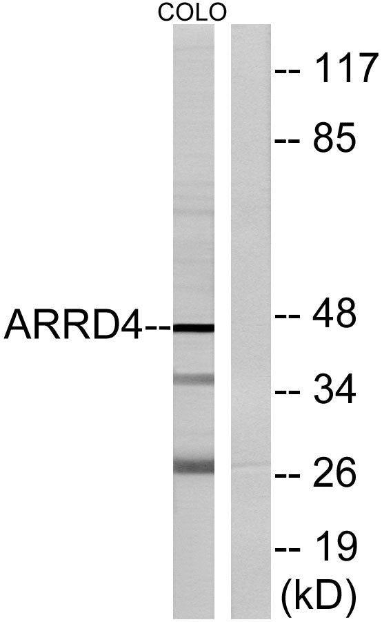 Arrdc4 Rabbit Polyclonal Antibody