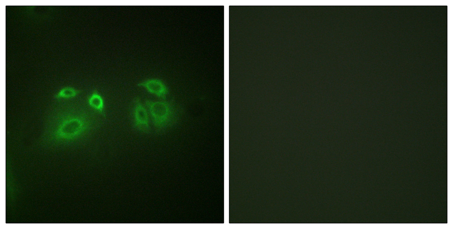 Arrestin-β-1 Rabbit Polyclonal Antibody