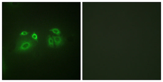 Arrestin-β-1 Rabbit Polyclonal Antibody