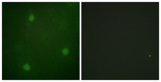 Artemis Rabbit Polyclonal Antibody