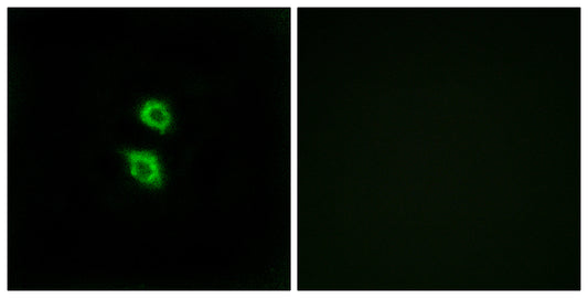 Arylsulfatase D Rabbit Polyclonal Antibody