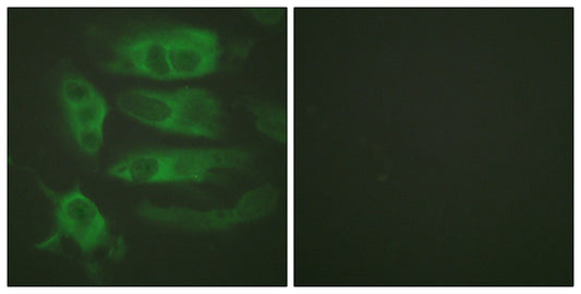 AR-β2 Rabbit Polyclonal Antibody